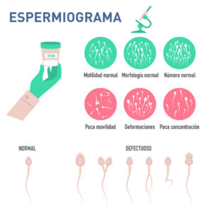 Espermiograma
