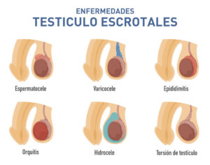 Enfermedades testículo escrotales