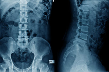Radiología