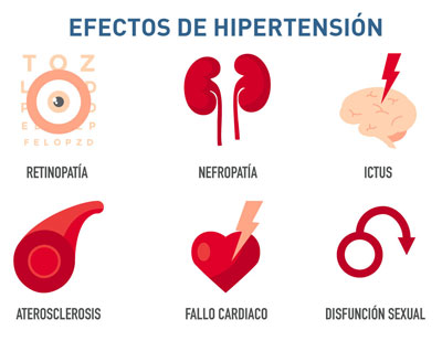 Efectos de la Hipertensión arterial